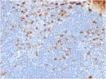 IHC testing of FFPE human tonsil tissue with recombinant Kappa Light Chain antibody (clone rL1C1). Required HIER: boil tissue sections in pH 9 10mM Tris with 1mM EDTA for 10-20 min followed by cooling at RT for 20 min.