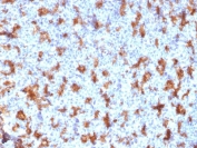 IHC testing of FFPE human tonsil with CD11c antibody (clone ITGAX/2507). Required HIER: boil tissue sections in pH6, 10mM citrate buffer, for 10-20 min followed by cooling at RT for 20 min.