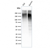 Ki-67 Antibody for WB. Western blot testing of human Raji and Ramos cell lysate with Ki-67 Antibody for WB MKI67/2462. Expected molecular weight ~350 kDa.