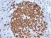 Ki-67 Antibody - Protein Microarray Validated / MKI67 Microarray Validated Antibody (clone MKI67/2465). Immunohistochemistry analysis of FFPE human tonsil tissue using protein microarray validated Ki-67 antibody (clone MKI67/2465). Strong nuclear brown staining is observed in numerous proliferating lymphoid cells within the tonsillar germinal center, consistent with the known expression pattern of Ki-67 / MKI67 in actively dividing cells. The microarray validated antibody highlights proliferating lymphocytes while surrounding non-proliferating stromal and background cells show minimal staining. Heat-induced epitope retrieval was performed by boiling tissue sections in 10mM citrate buffer (pH6) for 10-20 minutes followed by cooling at room temperature prior to staining.