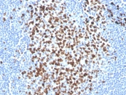 Ki-67 Antibody Biotin Conjugate / MKI67 Biotinylated Antibody (clone MKI67/2465). Immunohistochemistry analysis of FFPE human tonsil tissue using Ki-67 Antibody Biotin Conjugate (clone MKI67/2465). Strong nuclear brown staining is observed in numerous proliferating lymphoid cells within the germinal center region of the tonsil, consistent with the known expression pattern of Ki-67 / MKI67 in actively dividing cells. The biotin-conjugated antibody format enables detection through avidin-biotin based staining systems, producing clear nuclear labeling of proliferating lymphocytes within the lymphoid follicle. Heat-induced epitope retrieval was performed by boiling tissue sections in pH 9 10mM Tris with 1mM EDTA for 20 minutes followed by cooling prior to staining.