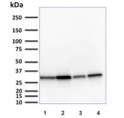 MTAP Antibody Multi-Cell Line WB. Western blot analysis of human HeLa, A431, HepG2, and HAP-1 cell lysates using MTAP Antibody (clone MTAP/1813) detects a band at approximately 26-38 kDa, consistent with the predicted molecular weight of Methylthioadenosine phosphorylase (MTAP) and reflecting the presence of multiple isoforms of this metabolic enzyme across diverse human cell lines.