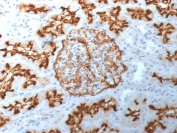 IHC staining of FFPE human kidney with CD10/Neprilysin antibody (clone MME/1892). Required HEIR: boil tissue sections in 10mM Tris with 1mM EDTA, pH 9, for 10-20 min and allow to cool before testing.