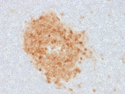 IHC staining of FFPE human tonsil with CD10 antibody (clone MME/1893). Required HEIR: boil tissue sections in 10mM Tris with 1mM EDTA, pH 9, for 10-20 min and allow to cool before testing.