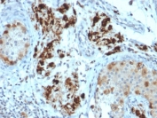 StAR Antibody Microarray Specificity Validated Clone STAR/2154. Immunohistochemistry analysis of Steroidogenic Acute Regulatory Protein (StAR / STARD1) in FFPE human adrenal gland tissue using a mouse monoclonal antibody validated by large-scale protein microarray specificity screening. HRP-DAB brown cytoplasmic staining highlights steroidogenic cells of the adrenal cortex, consistent with the mitochondrial localization of StAR in steroid hormone-producing endocrine cells, while surrounding non-steroidogenic tissues show minimal staining. Heat-induced epitope retrieval was performed by boiling tissue sections in pH 9 Tris-EDTA buffer (10 mM Tris with 1 mM EDTA) for 10-20 minutes followed by cooling at room temperature for 20 minutes prior to antibody staining.