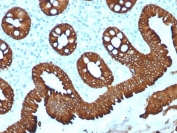 Cytokeratin 20 Antibody for IHC. Immunohistochemistry analysis of human colon tissue using protein microarray validated Cytokeratin 20 antibody (clone KRT20/1992). HRP-DAB brown chromogenic staining highlights cytoplasmic Keratin 20 / Cytokeratin 20 (KRT20) expression in epithelial cells lining colonic glandular crypts, while surrounding stromal cells remain largely negative. This staining pattern reflects the expected epithelial localization of this intermediate filament protein in gastrointestinal mucosa. Required HIER: boil tissue sections in 10 mM citrate buffer, pH 6, for 10-20 min followed by cooling at RT for 20 min.