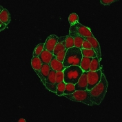 GLUT1 Immunofluorescence Antibody staining in human K562 cells. Fluorescent staining shows green signal corresponding to GLUT1 (SLC2A1) localization outlining the plasma membrane of individual cells, consistent with membrane-associated glucose transporter distribution. The membrane fluorescence delineates cell boundaries while weaker cytoplasmic fluorescent signal reflects intracellular transporter pools. Nuclei are counterstained with Reddot nuclear stain (red). Signal was detected using an immunofluorescence method and visualized by fluorescence microscopy.
