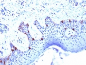 Melanoma gp100 Antibody with Microarray Specificity Validation (clone PMEL/2039). Immunohistochemistry analysis of human skin tissue stained with Melanoma gp100 Antibody Microarray Specificity Validation clone PMEL/2039. FFPE skin sections show focal HRP-DAB brown cytoplasmic staining in scattered melanocytes located along the basal layer of the epidermis, consistent with expression of Premelanosome protein PMEL, also known as gp100, a melanosome-associated glycoprotein characteristic of melanocytic lineage. Keratinocytes within the epidermis and underlying dermal structures show minimal background staining. Heat-induced epitope retrieval was performed in 10mM citrate buffer pH 6 by boiling for 10-20 minutes followed by cooling at room temperature for 20 minutes prior to antibody incubation.