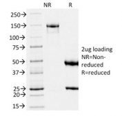 SDS-PAGE analysis of purified, BSA-free Melanoma gp100 antibody (clone PMEL/2039) as confirmation of integrity and purity.