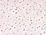 IHC staining of FFPE human brain with Ubiquitin/UBB antibody (clone UBB/1748). Required HIER: boil tissue sections in 10mM citrate buffer, pH 6, for 10-20 min followed by cooling at RT for 20 min.