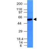 Vimentin Antibody Clone VM452 / VIM Mesenchymal Marker Antibody Raji Cell WB. Western blot analysis of Raji cell lysate using Vimentin Antibody Clone VM452 / VIM Mesenchymal Marker Antibody. A distinct immunoreactive band is detected at approximately 53-58 kDa, consistent with the expected molecular weight of vimentin, supporting specific detection of the endogenous type III intermediate filament protein in Raji cells.