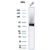 Vimentin Antibody Clone VM452 / VIM Mesenchymal Marker Antibody U-87 MG Cell WB. Western blot analysis of U-87 MG cell lysate using Vimentin Antibody Clone VM452 / VIM Mesenchymal Marker Antibody. A distinct immunoreactive band is detected at approximately 53-58 kDa, consistent with the expected molecular weight of vimentin, supporting specific detection of the endogenous type III intermediate filament protein in U-87 MG cells.