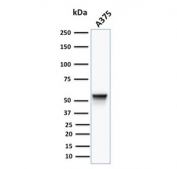 Vimentin Antibody Clone VM452 / VIM Mesenchymal Marker Antibody A375 Cell WB. Western blot analysis of A375 cell lysate using Vimentin Antibody Clone VM452 / VIM Mesenchymal Marker Antibody. A distinct immunoreactive band is detected at approximately 53-58 kDa, consistent with the expected molecular weight of vimentin, supporting specific detection of the endogenous type III intermediate filament protein in A375 melanoma cells.