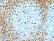 ZAP70 Antibody / Cytotoxic Lymphocyte Signaling Antibody. Immunohistochemistry analysis of formalin-fixed, paraffin-embedded human tonsil tissue using ZAP70 Antibody / Cytotoxic Lymphocyte Signaling Antibody (clone ZAP70/2035). Antigen retrieval was performed by boiling sections in pH 9 Tris-EDTA buffer for 10-20 minutes followed by cooling at room temperature. Cytoplasmic HRP-DAB brown staining is observed in lymphoid cell populations, with stronger staining in interfollicular regions surrounding lighter germinal centers. This pattern is consistent with Zeta-chain-associated protein kinase 70 (ZAP70) expression in cytotoxic T lymphocytes, highlighting effector cell-rich areas and supporting its role in cytotoxic lymphocyte signaling within tonsillar tissue architecture.