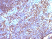 IHC staining of FFPE human tonsil tissue with CD45 antibody. HIER: boil tissue sections in pH 9 10mM Tris with 1mM EDTA for 20 min and allow to cool before testing.