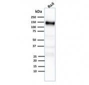 CD21 Antibody Raji WB. Western blot analysis of Complement Receptor 2 / CD21 in human Raji cell lysate using mouse monoclonal CD21 antibody, clone CR2/2754. A band is detected at approximately 140â160 kDa, consistent with the predicted molecular weight of glycosylated CD21, which migrates above its theoretical mass of approximately 105 kDa due to extensive post-translational glycosylation characteristic of this B-cell surface receptor.