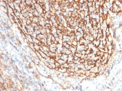 CD21 Antibody Tonsil IHC. Immunohistochemistry of Complement Receptor 2 / CD21 in FFPE human tonsil tissue using mouse monoclonal CD21 antibody, clone CR2/2754. HRP-DAB brown staining highlights a dense reticular follicular dendritic cell network within germinal centers, with accompanying membranous staining of B lymphocytes, consistent with CD21 localization in B-cell-rich regions, while nuclei are counterstained blue. Heat induced epitope retrieval was performed by boiling tissue sections in pH 6 10 mM citrate buffer for 10-20 min followed by cooling at RT prior to staining.