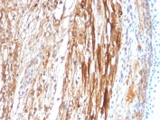 CRYAB Antibody Rat Heart Tissue IHC. Immunohistochemistry staining of FFPE rat heart tissue with CRYAB antibody (clone CPTC-CRYAB-1). HIER: boil tissue sections in pH6, 10mM citrate buffer, for 10-20 min and allow to cool before testing.