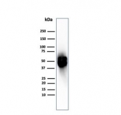 Thymidine Phosphorylase Antibody Spleen WB. Western blot analysis of human spleen tissue lysate using Thymidine Phosphorylase antibody detecting TYMP. A band is detected at approximately 50-55 kDa, consistent with the predicted molecular weight of TYMP. The observed signal aligns with expression of this cytosolic enzyme in lymphoid-rich tissue, supporting its role in nucleotide metabolism and angiogenesis-associated biological processes.