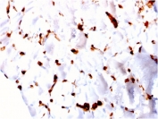 FABP5 Antibody Skeletal Muscle IHC. Immunohistochemistry testing of FFPE human skeletal muscle with FABP5 antibody. HIER: boiling tissue sections in pH 9 10mM Tris with 1mM EDTA for 10-20 min and allow to cool prior to staining.