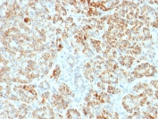 FXN Antibody Pancreatic Acinar Cell IHC. Immunohistochemistry staining of FFPE human pancreas using FXN antibody demonstrates diffuse granular cytoplasmic HRP-DAB brown staining within metabolically active pancreatic acinar cell populations, consistent with mitochondrial localization of Frataxin / FXN and its role in iron-sulfur cluster biogenesis and oxidative metabolic regulation. Required HIER: boil tissue sections in pH 9 10mM Tris with 1mM EDTA for 10-20 min and allow to cool before testing.