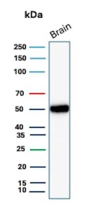 Western blot testing of human brain tissue lysate using GFAP antibody (clone GFAP/6884). Predicted molecular weight ~50 kDa.