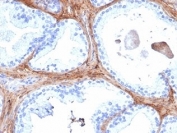 Decorin Antibody Human Prostate Tissue IHC. Immunohistochemistry of Decorin antibody in human prostate tissue. Formalin-fixed, paraffin-embedded human prostate was stained using Decorin antibody (clone DCN/6289). Heat induced epitope retrieval was performed by boiling tissue sections in 10mM Tris with 1mM EDTA, pH 9, for 20 min followed by cooling prior to staining. HRP-DAB brown chromogenic signal highlights extracellular stromal connective tissue surrounding prostatic glands, consistent with Decorin localization within the collagen-rich matrix.