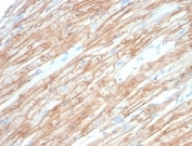 DMD Antibody Heart IHC. Immunohistochemistry staining of FFPE human heart tissue with DMD antibody (clone DMD/6270). HIER: boil tissue sections in pH 9 10mM Tris with 1mM EDTA for 20 min and allow to cool before testing.