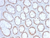SATB2 Antibody Colon Immunohistochemistry. IHC staining of FFPE human colon tissue with SATB2 antibody (clone SATB2/7111). HIER: boil tissue sections in pH 9 10mM Tris with 1mM EDTA for 20 min and allow to cool before testing.
