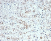 Interleukin-6 Antibody Human Adrenal Gland IHC. Immunohistochemical staining of FFPE human adrenal gland tissue using Interleukin-6 Antibody / IL6 Antibody (clone IL6/4647) demonstrates granular cytoplasmic HRP-DAB brown staining within scattered adrenal cortical cells. The observed staining pattern is consistent with expression of IL6, a multifunctional cytokine involved in inflammatory signaling, immune regulation, stress responses, and communication between endocrine and immune systems. Detection of IL6 within adrenal tissue supports the utility of this antibody for investigating cytokine-mediated signaling pathways and inflammatory mechanisms across endocrine and immune-related research applications. HIER: boil tissue sections in pH 9 10mM Tris with 1mM EDTA for 20 min and allow to cool before testing.