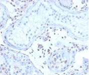 IHC staining of FFPE human testis tissue with MGMT antibody (clone MGMT/4791). HIER: boil tissue sections in pH 9 10mM Tris with 1mM EDTA for 20 min and allow to cool before testing.