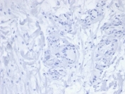Negative control: IHC staining of FFPE human skin tissue with recombinant PDCD1 antibody (clone PDCD1/7125). HIER: boil tissue sections in pH 9 10mM Tris with 1mM EDTA for 20 min and allow to cool before testing.