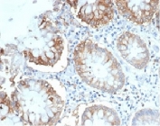 Immunohistochemistry analysis of LFA-2 antibody (clone LFA2/7100) in human colon tissue. Formalin-fixed, paraffin-embedded colon demonstrates membranous HRP-DAB brown staining in scattered lymphoid cells within the lamina propria, consistent with CD2 expression on resident T lymphocytes. Colonic epithelial cells lining the glands are largely negative, highlighting the expected immune cell-restricted expression pattern. Hematoxylin counterstain delineates nuclear morphology and glandular architecture. Heat-induced epitope retrieval was performed by boiling tissue sections in 10 mM Tris with 1 mM EDTA, pH 9.0, for 20 minutes followed by cooling prior to staining.