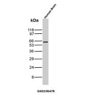 GAD2 Antibody Brain WB. Western blot analysis of human brain tissue lysate using GAD2 Antibody detects a strong band at approximately 65-67 kDa, consistent with the expected molecular weight of Glutamate decarboxylase 2 / GAD65. This Glutamate decarboxylase 2 antibody highlights abundant expression of inhibitory neurotransmitter-associated signaling machinery within neural tissue and supports characterization of GABAergic neuronal differentiation pathways.