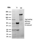 SDS-PAGE analysis of purified, BSA-free GAD65 antibody recombinant rabbit mAb GAD2/6488R as confirmation of integrity and purity.