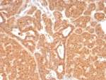 Immunohistochemistry analysis of c-RET / RET Tyrosine Kinase Receptor antibody (clone RET/8789) in human parathyroid tissue. FFPE human parathyroid demonstrates diffuse membranous and cytoplasmic HRP-DAB brown staining in parathyroid epithelial cells, consistent with RET expression. Staining is strong and relatively uniform across the glandular cell population, with clear membrane accentuation outlining individual cells. Stromal elements show comparatively weaker signal. Nuclei are counterstained blue. Heat induced epitope retrieval was performed by boiling tissue sections in 10 mM Tris with 1 mM EDTA, pH 9.0, for 20 minutes followed by cooling prior to immunostaining.