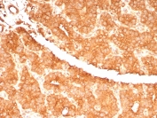 Immunohistochemistry analysis of c-RET / MEN2-Associated RET Protein antibody (clone RET/7694) in human parathyroid gland tissue. FFPE human parathyroid demonstrates strong membranous and cytoplasmic HRP-DAB brown staining in parathyroid epithelial cells, consistent with RET expression. Staining is diffuse and uniform across the glandular cell population with clear membrane accentuation outlining individual cells, while surrounding stromal components show comparatively weaker signal. Nuclei are counterstained blue. Heat induced epitope retrieval was performed by boiling tissue sections in 10 mM Tris with 1 mM EDTA, pH 9.0, for 20 minutes followed by cooling prior to immunostaining.