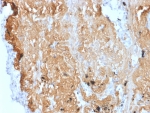 ZNF488 Antibody Uterus IHC. Immunohistochemistry analysis of FFPE human uterus tissue using ZNF488 antibody. The mouse monoclonal antibody clone PCRP-ZNF488-2D8 shows nuclear staining in epithelial cells, consistent with Zinc finger protein 488 / ZNF488 localization as a transcription factor marker. Signal is observed within cell nuclei of glandular and stromal compartments, reflecting transcriptional regulatory activity, while background staining remains low. HIER: boil tissue sections in 10 mM Tris with 1 mM EDTA, pH 9, for 20 min followed by cooling prior to staining.