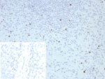 Immunohistochemistry analysis of Perforin-1 antibody in human spleen tissue. Formalin-fixed, paraffin-embedded human spleen stained with Perforin-1 antibody (clone PRF1/8662R) demonstrates discrete cytoplasmic HRP-DAB brown staining in scattered lymphoid cells within the splenic white pulp, consistent with perforin localization in cytotoxic T lymphocytes and natural killer cells. Most surrounding lymphocytes remain negative, highlighting the selective expression pattern of PRF1 in activated cytotoxic populations. The inset image shows the negative control in which PBS was used in place of the primary antibody, confirming absence of non-specific secondary antibody staining. Heat-induced epitope retrieval was performed by boiling tissue sections in pH 9, 10mM Tris with 1mM EDTA for 20 minutes followed by cooling prior to immunostaining.