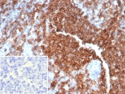 IHC analysis of CD39 Antibody in FFPE human lymph node tissue. The antibody for IHC (clone CD39/6860) demonstrates strong membranous HRP-DAB brown staining in lymphocytes within cortical and paracortical regions, consistent with ENTPD1 / CD39 expression, while surrounding stromal elements are largely negative. The inset shows PBS used in place of the primary antibody as a secondary-only negative control. Heat-induced epitope retrieval was performed in 10mM Tris with 1mM EDTA, pH 9.0, at 95oC for 20 minutes followed by cooling before testing.