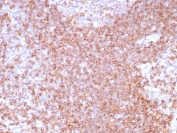 IHC analysis of CD39 Antibody in FFPE human tonsil tissue. The rabbit monoclonal antibody (clone CD39/8538R) demonstrates membranous HRP-DAB brown staining in lymphocytes within germinal centers and interfollicular regions, consistent with ENTPD1 / CD39 expression. Heat-induced epitope retrieval was performed in 10mM Tris with 1mM EDTA, pH 9.0, at 95oC for 20 minutes followed by cooling before testing.