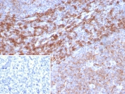 IHC analysis of CD39 Antibody in FFPE human tonsil tissue. The recombinant rabbit monoclonal antibody (clone CD39/8162R) demonstrates membranous HRP-DAB brown staining in lymphoid cells within germinal centers and interfollicular regions, consistent with ENTPD1 / CD39 expression, while background stromal elements are largely negative. The inset shows PBS used in place of the primary antibody as a secondary-only negative control. Heat-induced epitope retrieval was performed in 10mM Tris with 1mM EDTA, pH 9.0, at 95oC for 20 minutes followed by cooling before testing.