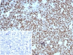 Ki-67 Antibody Recombinant Mouse MAb rMKI67/8852. Immunohistochemistry analysis of FFPE human tonsil tissue using Ki-67 antibody recombinant mouse mAb (clone rMKI67/8852). Strong nuclear brown staining is observed in numerous proliferating lymphoid cells within the tonsillar germinal center, consistent with the known expression pattern of Ki-67 / MKI67 in actively dividing cells. Surrounding lymphoid and stromal cells show minimal staining. Inset: PBS was used in place of the primary antibody as a secondary antibody negative control. Heat-induced epitope retrieval was performed by boiling tissue sections in pH 9 10mM Tris with 1mM EDTA for 20 minutes followed by cooling prior to staining.