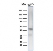Western blot testing of human THP-1 cell lysate with Wilms Tumor 1 antibody (clone WT1/7451). Expected molecular weight 47-55 kDa.