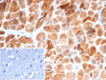 CRYAB Antibody Cardiac Muscle IHC. Immunohistochemistry of Alpha B crystallin / CRYAB in FFPE human heart tissue using mouse monoclonal CRYAB antibody, clone CRYAB/4663. HRP-DAB brown staining highlights strong cytoplasmic labeling of cardiomyocytes with a striated pattern consistent with contractile architecture and muscle structural stress response, while interstitial cells show minimal staining and nuclei are counterstained blue. Inset: PBS was used in place of primary antibody as a negative control to confirm specificity of staining. Heat induced epitope retrieval was performed by boiling tissue sections in pH 9 10 mM Tris with 1 mM EDTA for 20 min followed by cooling prior to staining.