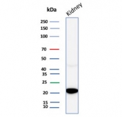 CRYAB Antibody Muscle Stress WB. Western blot analysis of Alpha B crystallin / CRYAB in human kidney tissue lysate using mouse monoclonal CRYAB antibody, clone CRYAB/4663. A band is detected at approximately 20 kDa, consistent with the predicted molecular weight of CRYAB, supporting detection of this small heat shock protein involved in cytoskeletal stabilization and structural stress response.