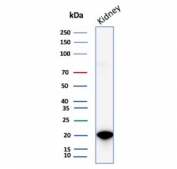 CRYAB Antibody Renal Tissue WB. Western blot analysis of Alpha B crystallin / CRYAB in human kidney tissue lysate using mouse monoclonal CRYAB antibody, clone CRYAB/4665. A band is detected at approximately 20 kDa, consistent with the predicted molecular weight of CRYAB, supporting detection of this small heat shock protein involved in molecular chaperone function and protein stabilization in renal tissue.
