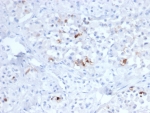 FSHB Antibody Sparse Gonadotroph IHC. Immunohistochemistry staining of FFPE human pituitary tissue using monoclonal clone FSHB/6845 demonstrates scattered granular cytoplasmic HRP-DAB brown staining within discrete endocrine cell populations, consistent with selective Follicle stimulating hormone beta / FSHB expression in gonadotroph-associated anterior pituitary cells. The focal staining distribution reflects the specialized hormone-producing nature of FSHB-positive endocrine compartments. HIER: boil tissue sections in pH 9 10mM Tris with 1mM EDTA for 20 min and allow to cool before testing.