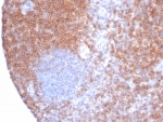 IHC staining of FFPE human tonsil tissue with CD6 antibody (clone rC6/372). HIER: boil tissue sections in pH 9 10mM Tris with 1mM EDTA for 20 min and allow to cool before testing.