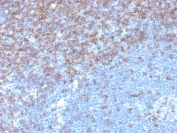 CD5 Antibody for IHC. Immunohistochemistry analysis of CD5 antibody staining in FFPE human tonsil tissue using a lymphoid malignancy marker antibody, clone rC5/6976. Strong membranous staining is observed in interfollicular T lymphocytes with dense labeling of T cell zones surrounding germinal centers, while follicular B cell areas remain largely negative. The staining pattern highlights normal tonsillar architecture and reflects the utility of CD5 in identifying lymphocyte populations relevant to lymphoid malignancy research and disease characterization. Heat-induced epitope retrieval was performed using pH 9 Tris-EDTA buffer for 20 minutes followed by cooling prior to antibody incubation.
